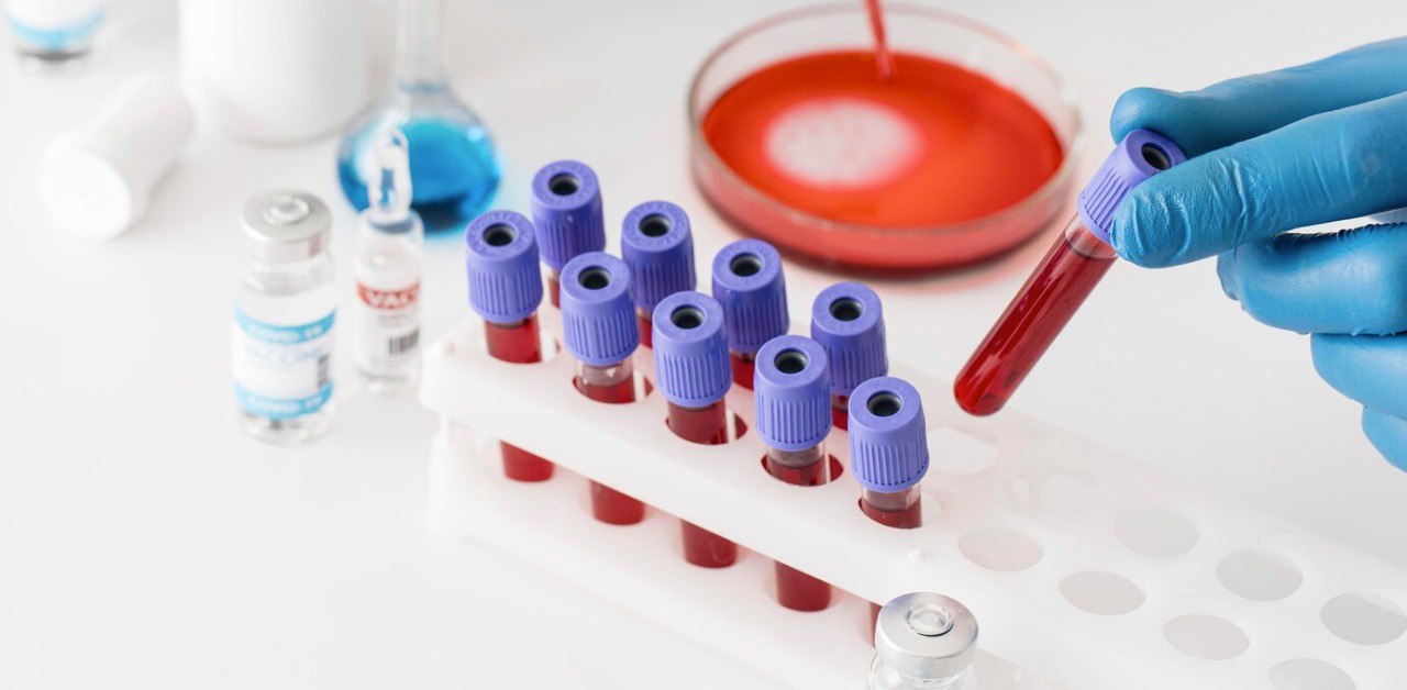 Gastroenterology: разработан новый точный тест на целиакию по анализу крови